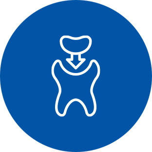 Restorative Composite Fillings